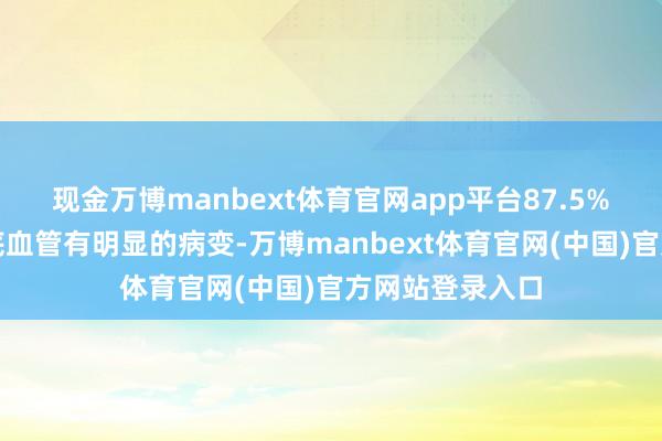 现金万博manbext体育官网app平台87.5%的东说念主眼底血管有明显的病变-万博manbext体育官网(中国)官方网站登录入口